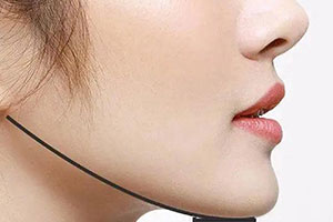 下颌角整形手术会导致下垂吗?及注意事项